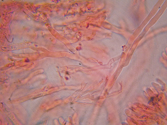 Phanerochaete raduloides? (Phanerochaete aculeata)