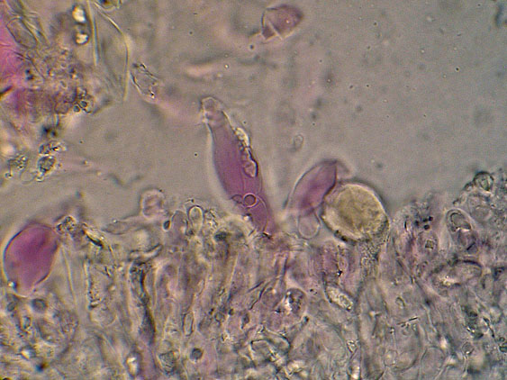 Peniophorella praetermissa (P. Karst.) K.H. Larss.