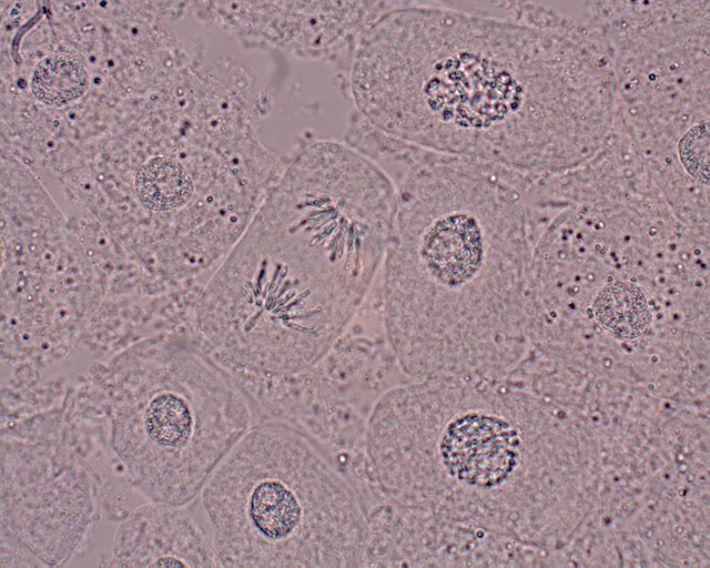 Ancora cellule in mitosi