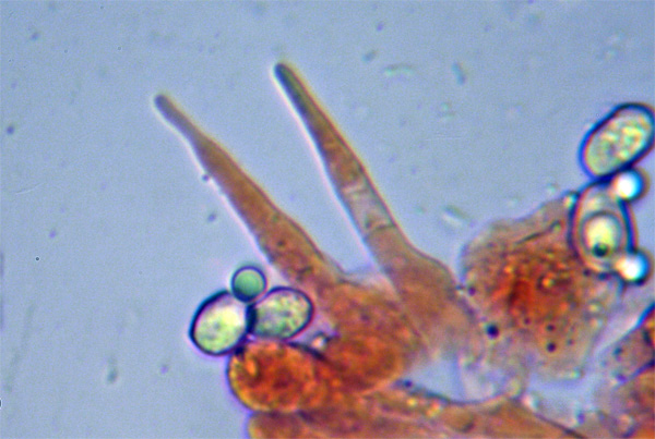 Melanoleuca (cfr. Melanoleuca spegazzinii)