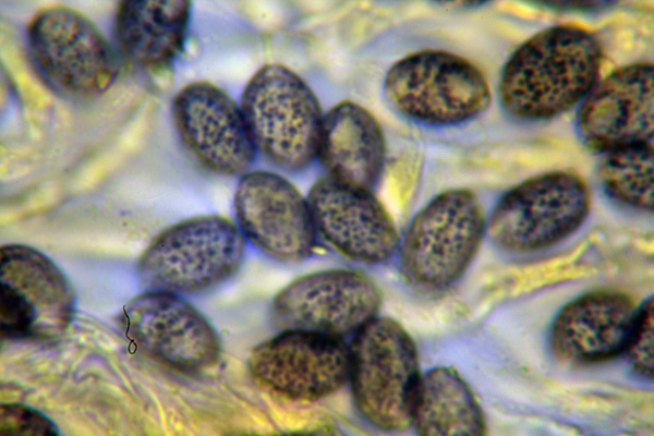 Melanoleuca (cfr. Melanoleuca spegazzinii)