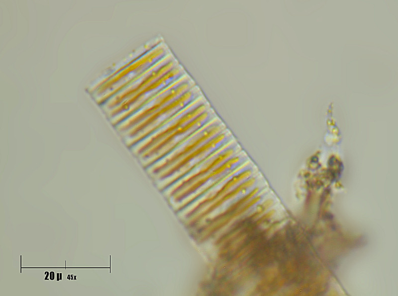 eunotia sp ???