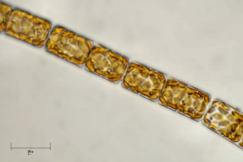 melosira sp. o alga gialla ?