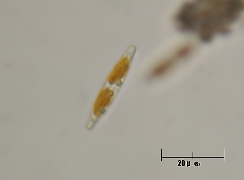 navicula sp ?????
