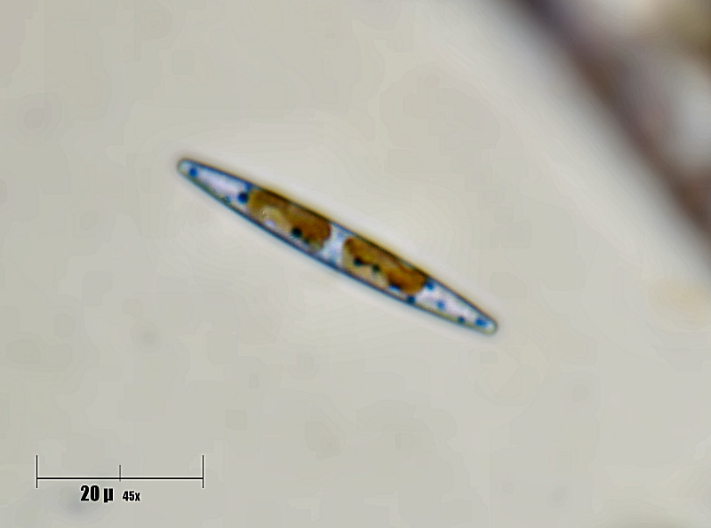 navicula sp ?????