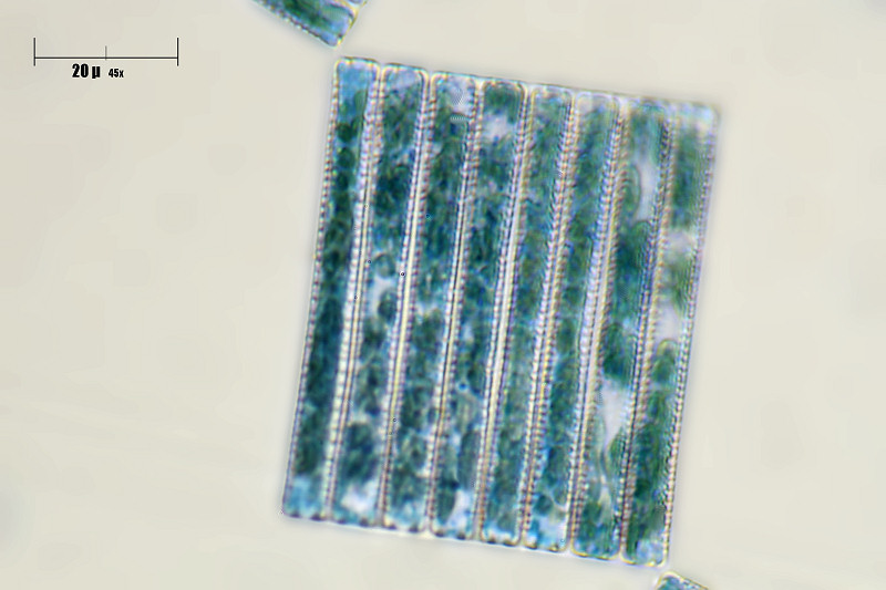tabellaria sp ?