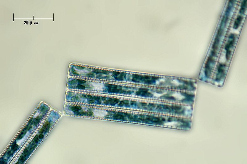 tabellaria sp ?