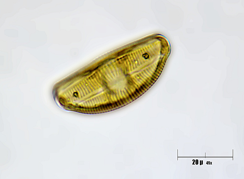 cymbella sp. 2
