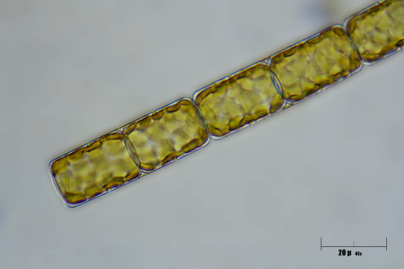 melosira sp. o alga gialla ?