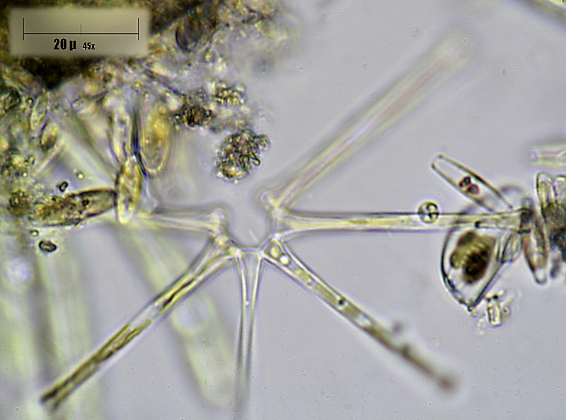 Asterionella formosa ?