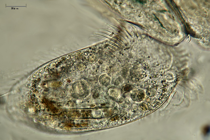 Stylonychia e anellide