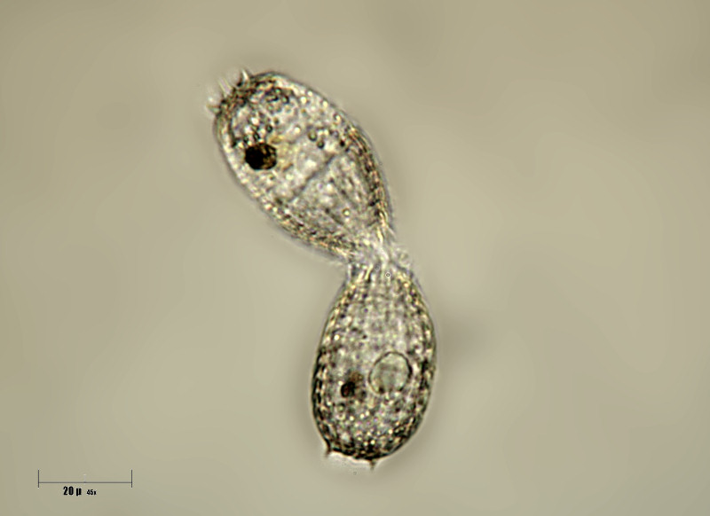 Coleps sp.  in divisione