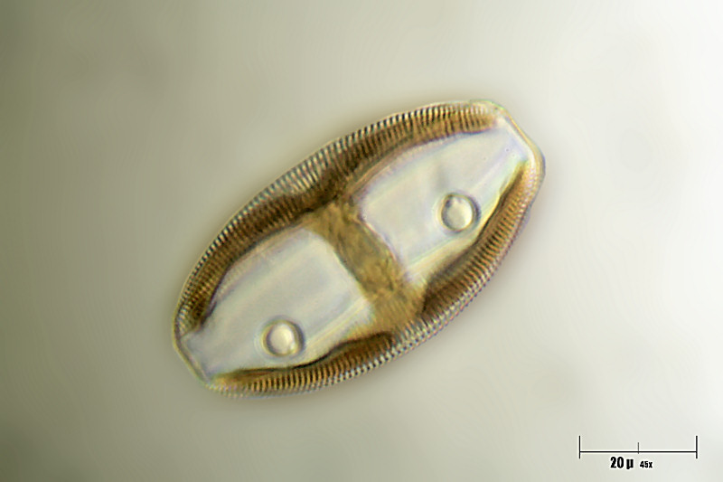 Amphora ovalis ??