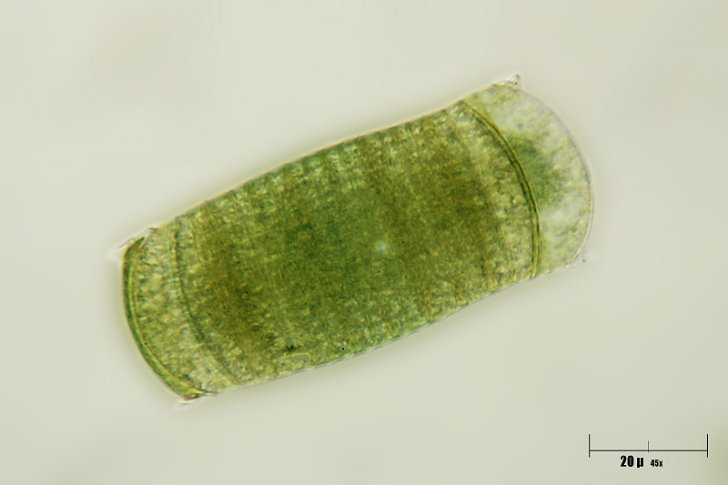 Oscillatoria sp. - ormigoni