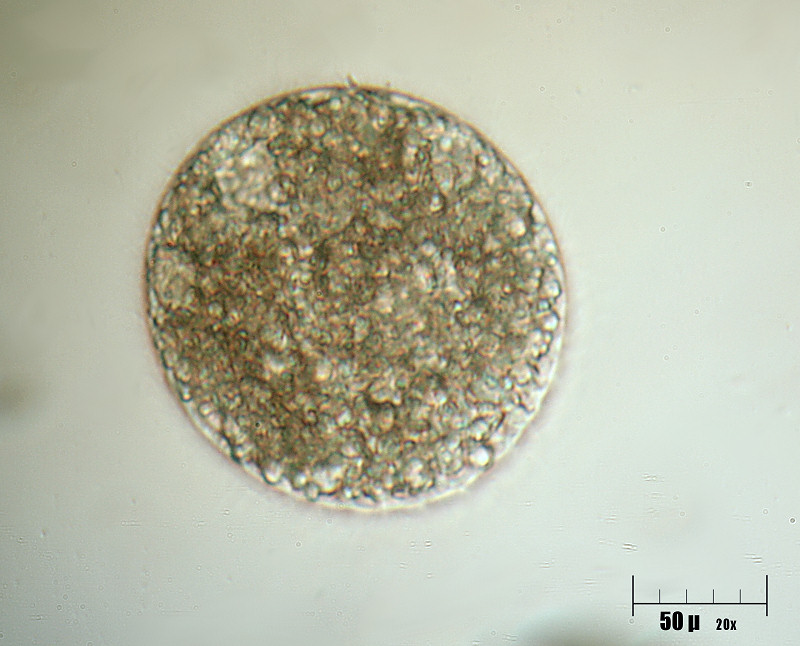 Che cosa � ?  Un''ameba ?