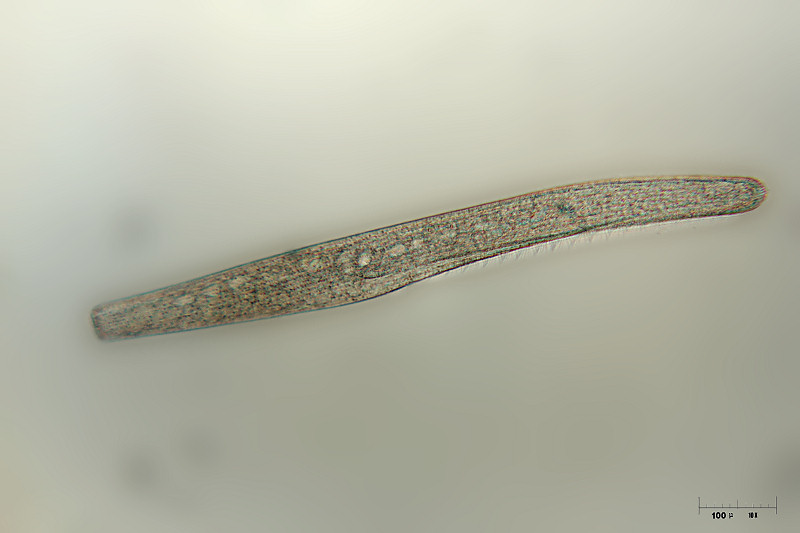 Spirostomum ambiguum