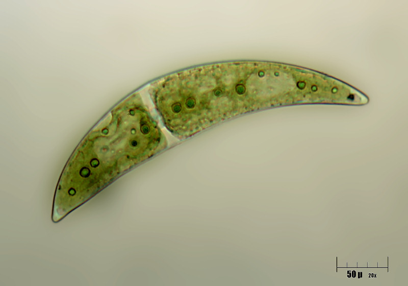 Closterium moniliferum
