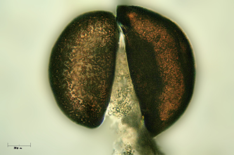 due Arcella vulgaris  in coniugazione