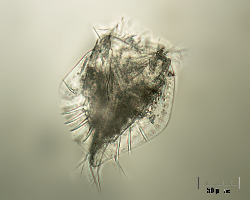 due Euplotes carinatus in coniugazione