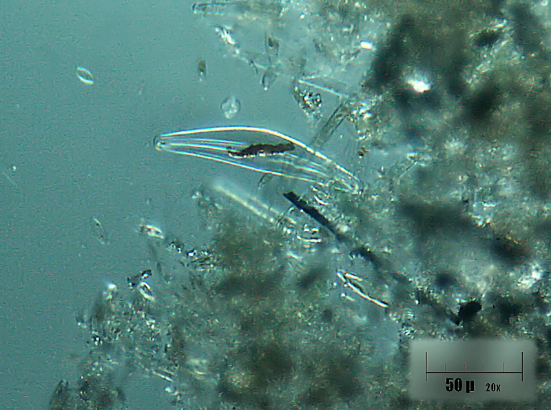 cymbella 2