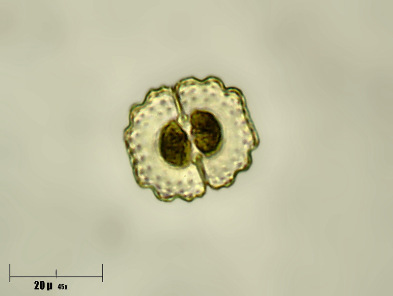 Cosmarium venustum