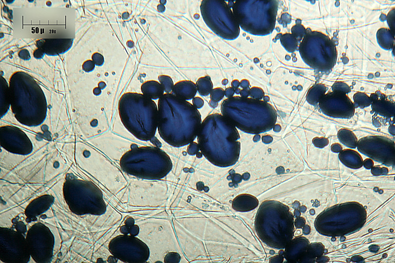 cellule di patata con granuli di amido
