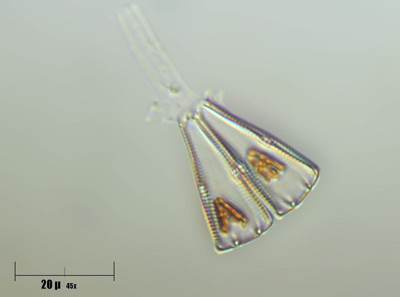 gomphonema sp.
