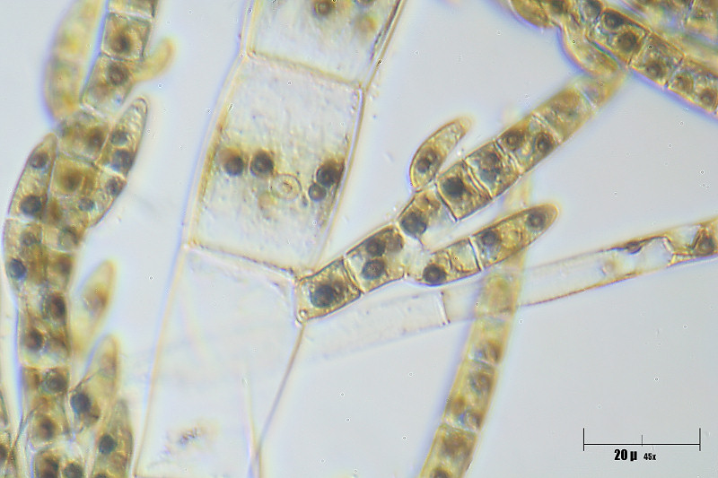 Draparnaldia sp.
