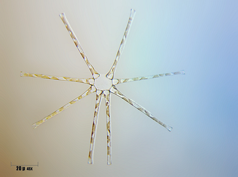 asterionella formosa 2