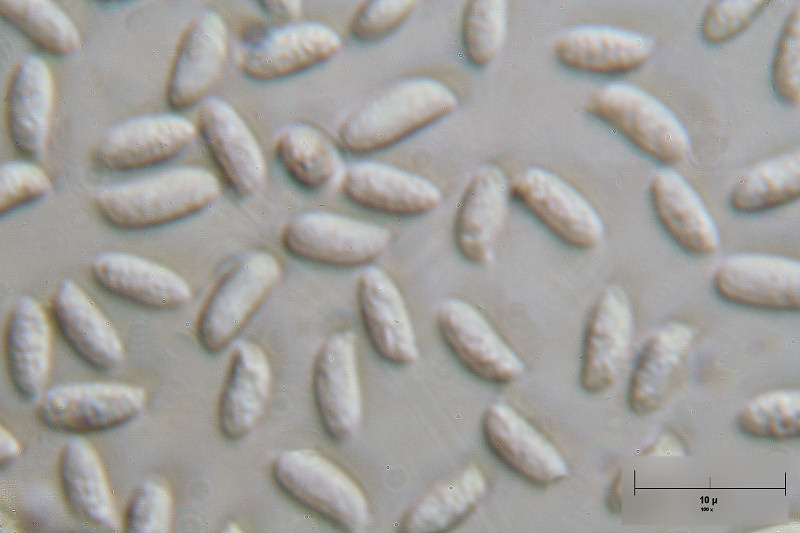 spore di Pleurotus ostreatus