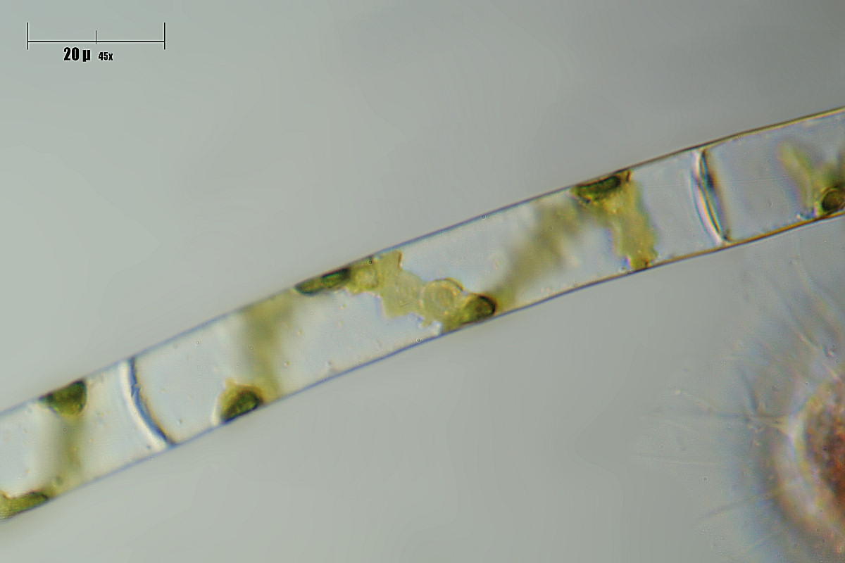 Spirogyra sp.