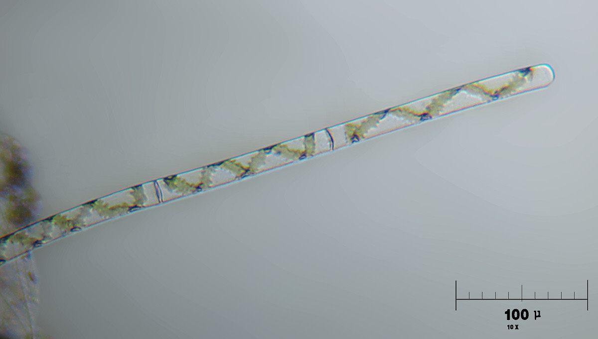 Spirogyra sp.