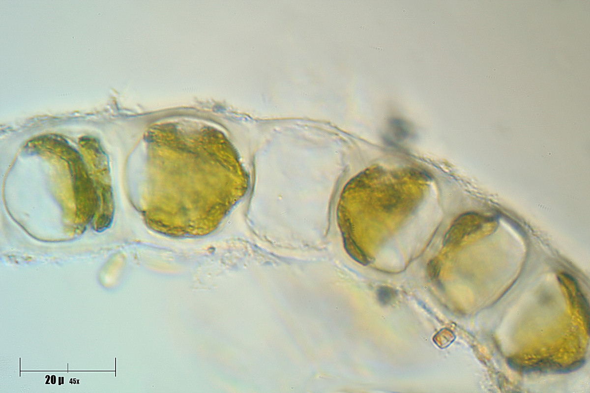 Nostoc sp. ?