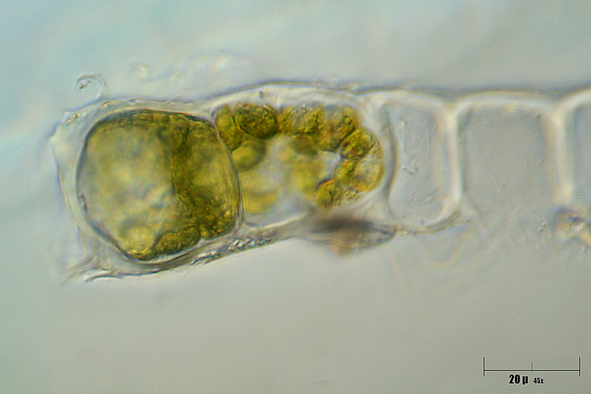 Nostoc sp. ?