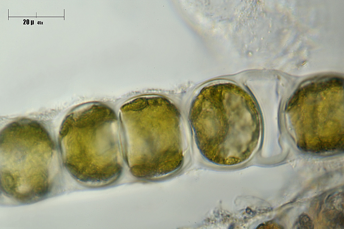 Nostoc sp. ?