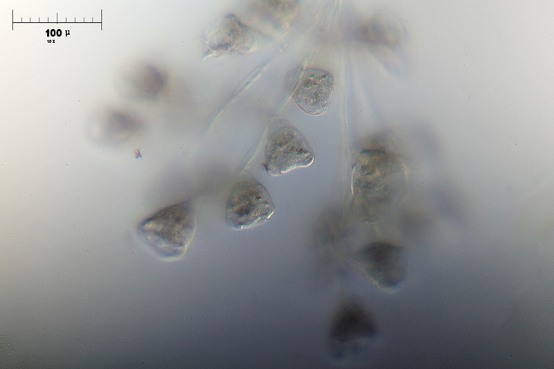 Carchesium pectinatum