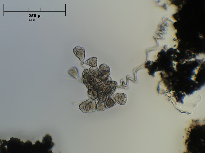 Carchesium pectinatum