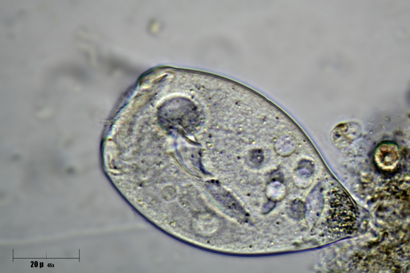 Vorticella sp. 2