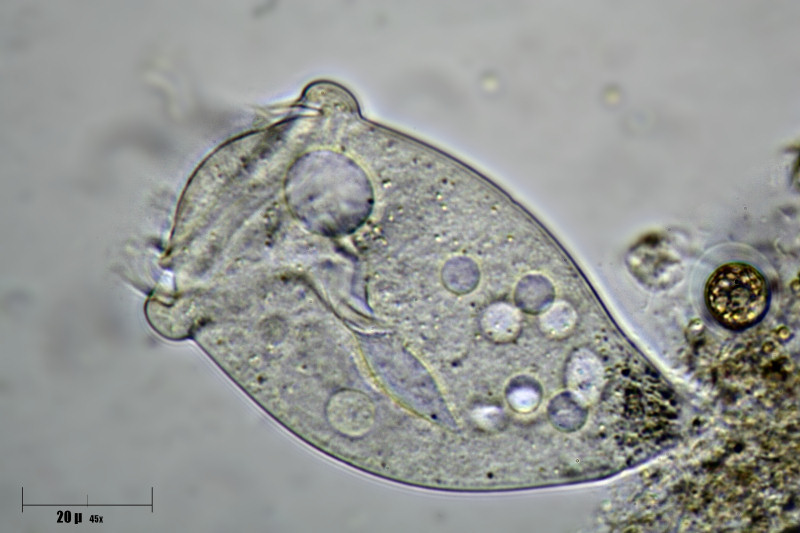 Vorticella sp. 2