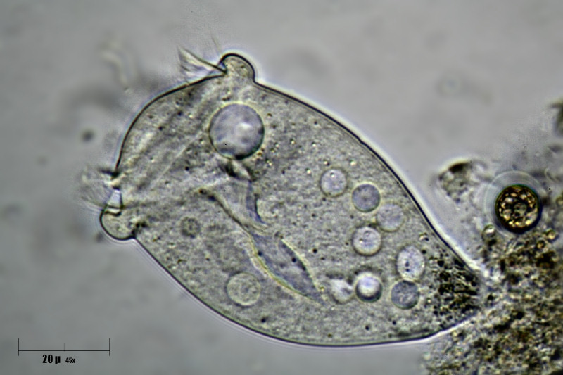 Vorticella sp. 2