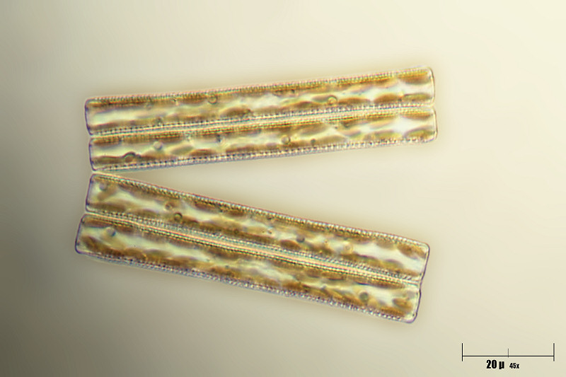Tabellaria sp.