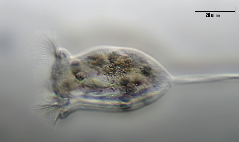 vorticella sp.