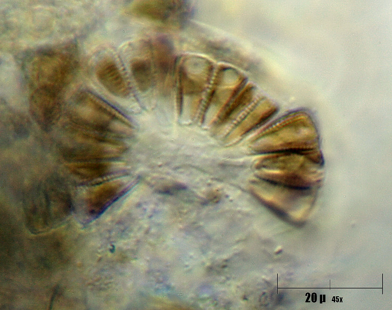 mazzo di gomphonema sp.