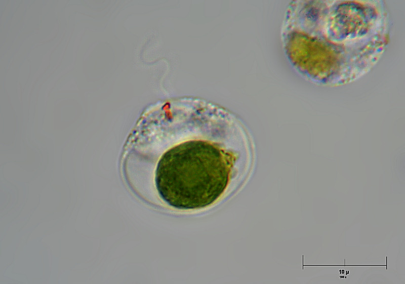 alga flagellata da identificare - Trachelomonas sp. ???