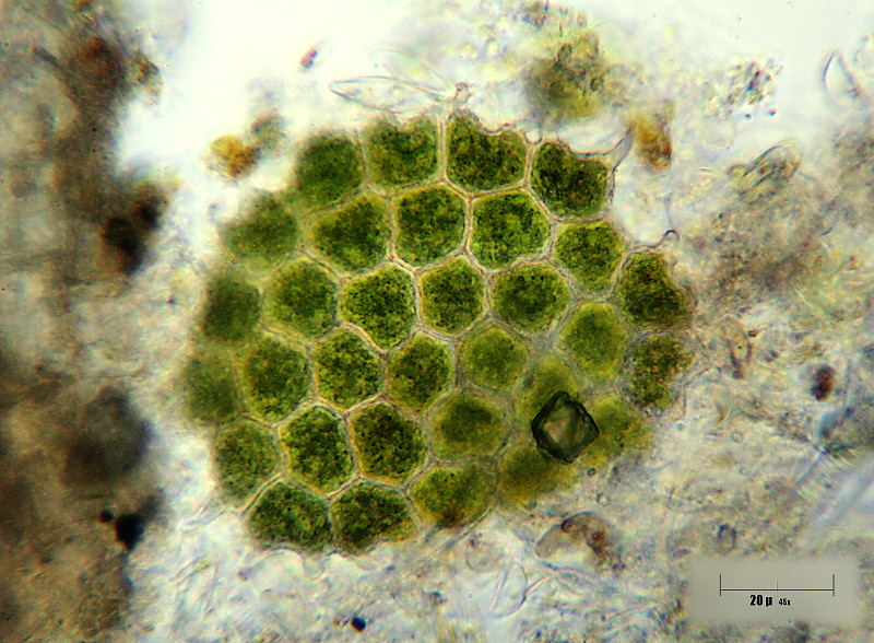 Pediastrum  boryanum