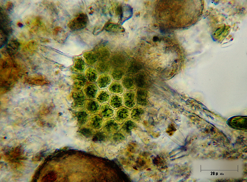 Pediastrum  boryanum