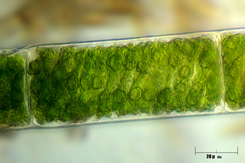 Spirogyra sp.
