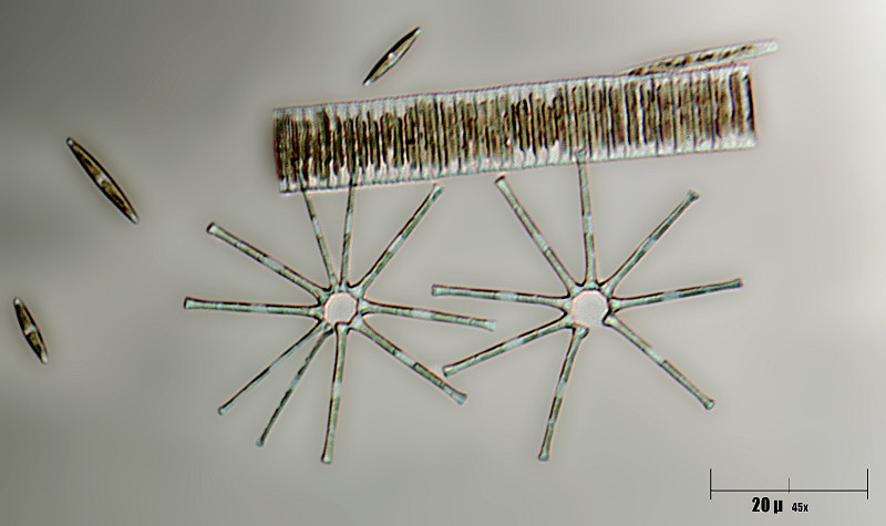 coppia di Asterionella formosa