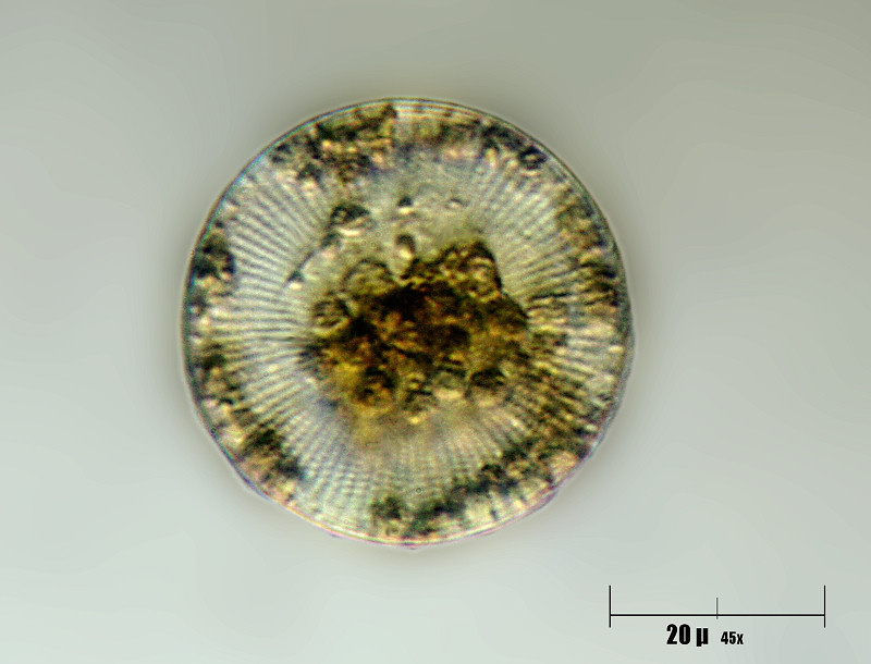 Stephanodiscus sp.
