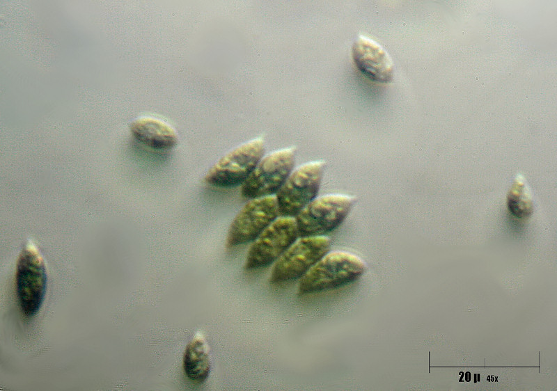 Scenedesmus acutus ??